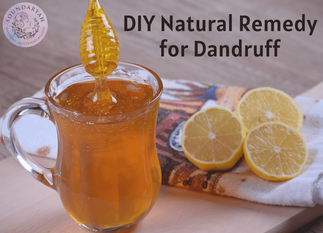 Struggling to get rid of those pesky white flakes on your hair and scalp? This DIY natural remedy for dandruff will get rid of them for good!